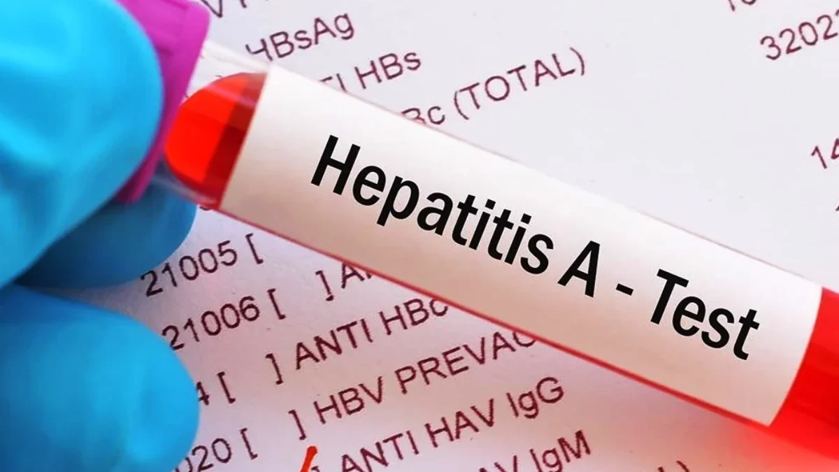 Waspadai Gejala Hepatitis A, Penyebab dan Cara Penularannya