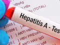 Waspadai Gejala Hepatitis A, Penyebab dan Cara Penularannya