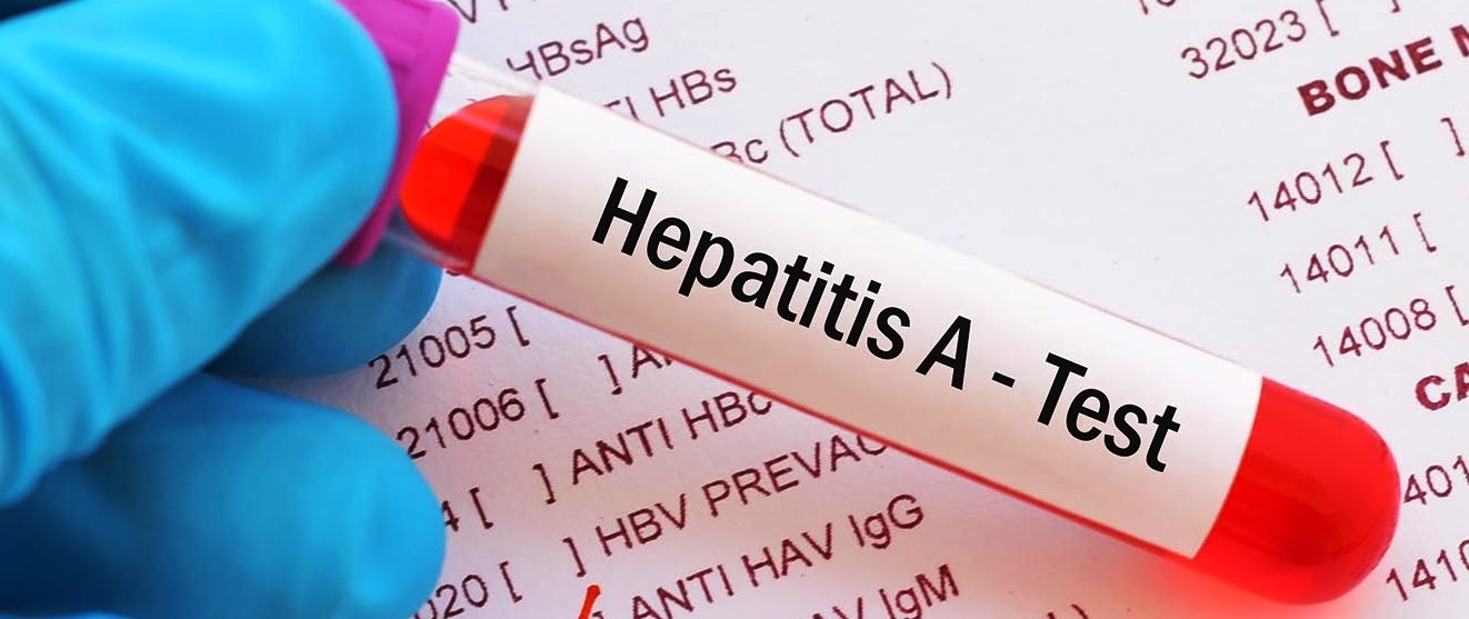 Waspadai Gejala Hepatitis A, Penyebab dan Cara Penularannya