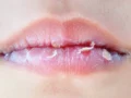 8 Tips Mengatasi Bibir Kering dan Mengelupas secara Alami, Mudah Dilakukan