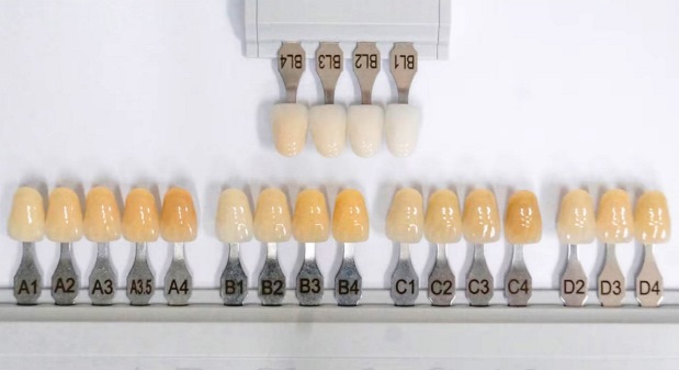 Shade Guide Warna Gigi